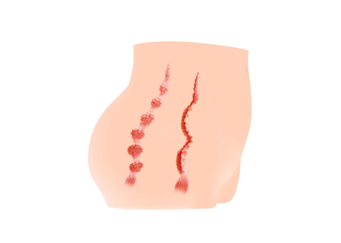 Мастурбатор-полуторс Kokos Cherry, два входи: вагіна і попка Мастурбатор-полуторс Kokos Cherry, два входи: вагіна і попка